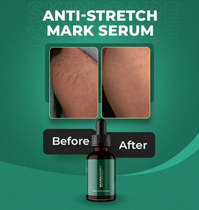 MarkAway Anti-Stretch Mark Serum 30 ML